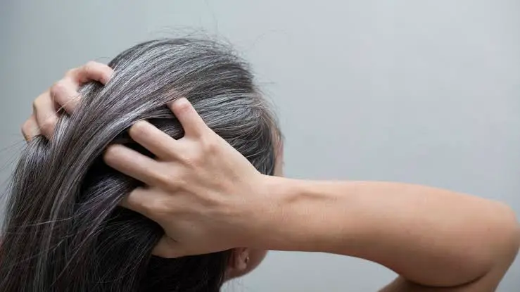what causes bald spots on your head