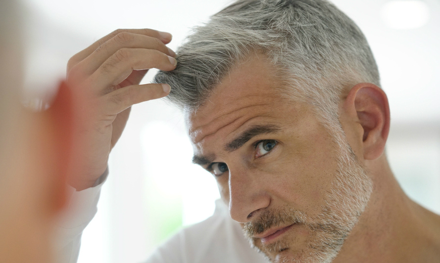 What Causes Bald Spots On Your Head Tips For Hair Growth